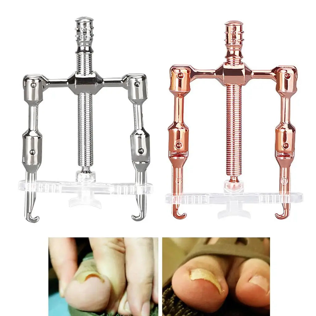 Stainless Steel Mini Gold/Silver Toe Nail Corrector Correction Fixer Recover Toe for Nail Tool Device Ingrown