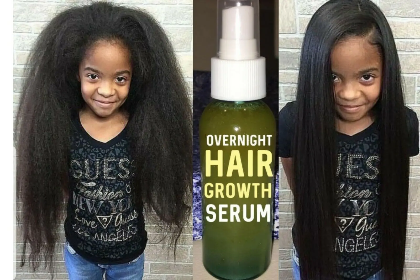 Overnight Hair Growth Serum, Thick Long Hair , Powerful Hair Growth Serum -  Hair Growth Essential Oils - AliExpress
