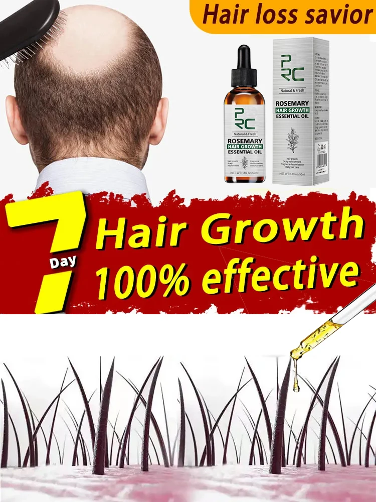 Best of Rosemary Oil Hair Growth For Men Women Fast Growing Products Essential Oils Ginger Anti Hair Loss Scalp Treatment Hair Care Reviews & Tips