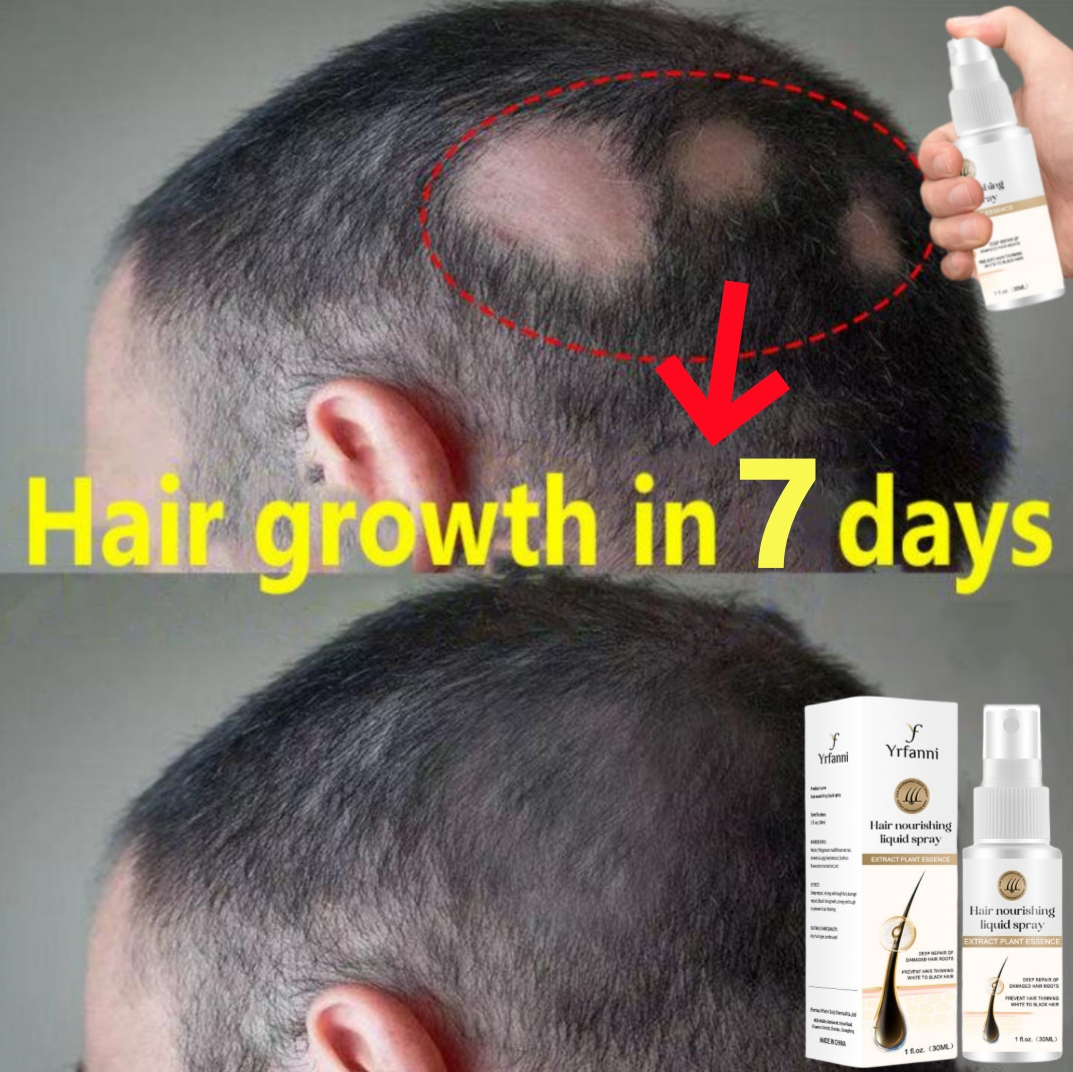 Best of Ginger Hair Growth Serum Spray Men Women Promote Hair Root Fast Grow Prevent Baldness Hair Loss Treatment Hair Regrowth Thicker Reviews & Tips