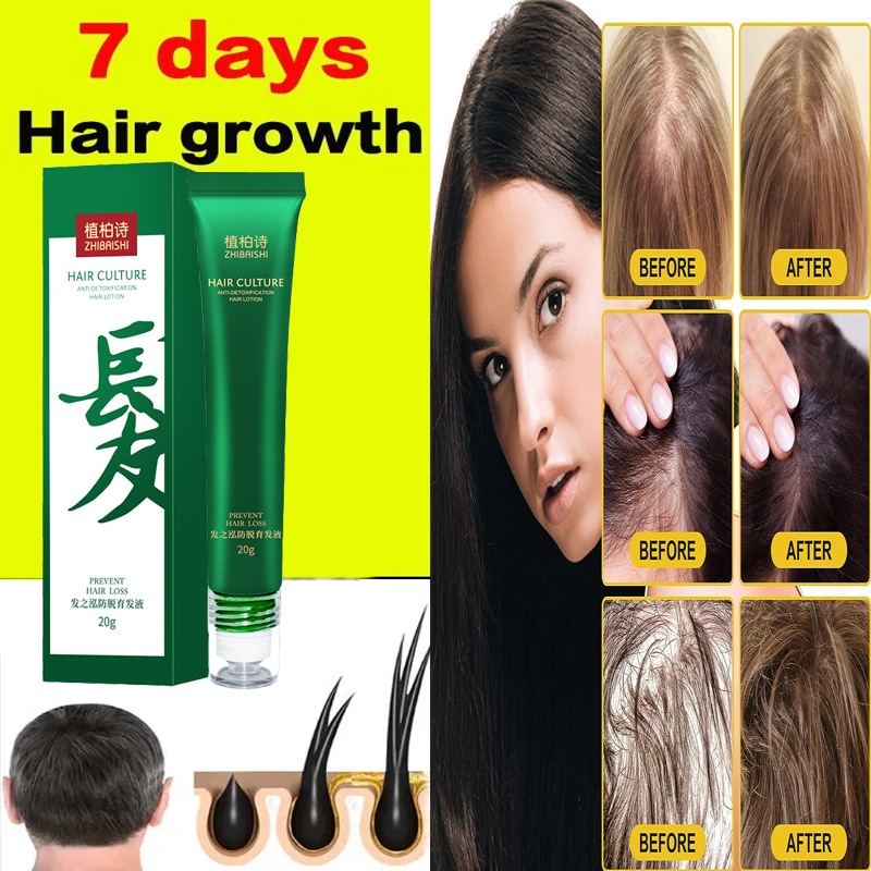 Best of Fast Hair Growth Oil Effective Baldness Repair Hereditary Hair Loss Postpartum Hair Loss Seborrheic Hair Loss Hair CareTreatment Reviews & Tips