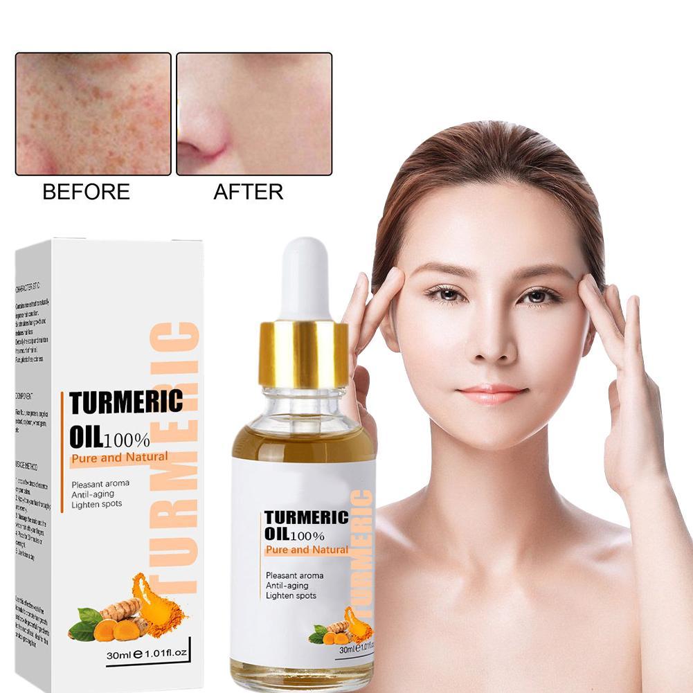 Best of 30ml Tumeric Serum Dark Spot Removal Pigment Correcting Facial Essence Turmeric Whitening Oil Beauty Face Skin Care Reviews & Tips