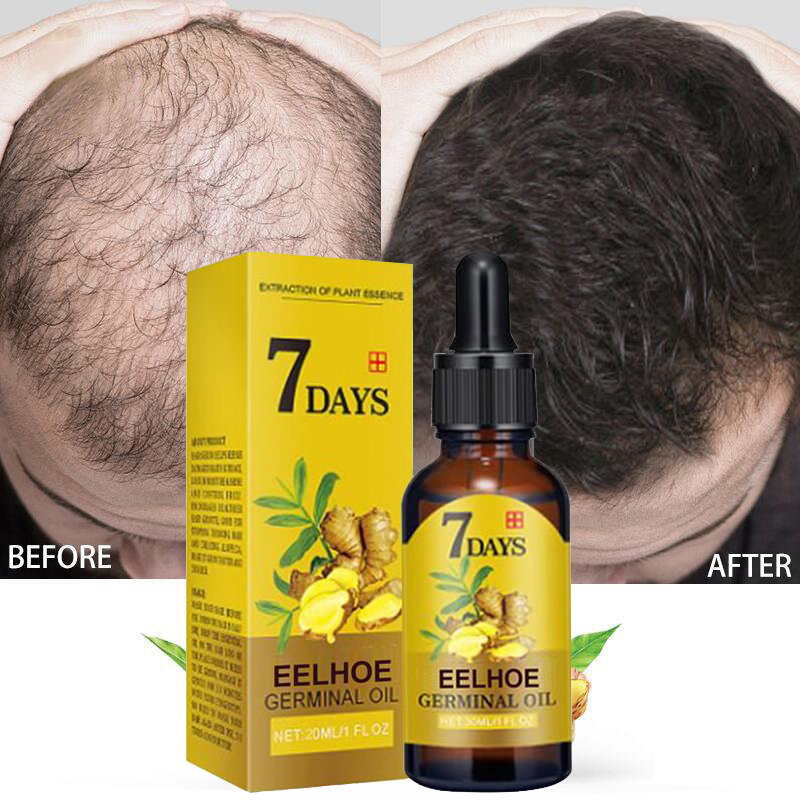 Best of Ginger Hair Growth Products Fast Growing Hair Essential Oil Natural Anti Hair Loss Prevent Hair Dry Frizzy Damaged Repair Care Reviews & Tips