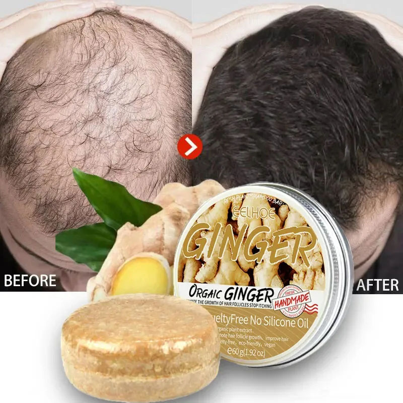 Best of Ginger Hair Growth Soap Fast Growing Anti Hair Loss Products Treatment Hair Dry Frizzy Damaged Repair Hair Care For Men Women Reviews & Tips