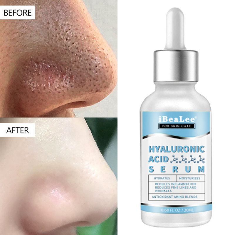 Best of Pore Shrinking Serum Hyaluronic Acid Cleaning Exfoliating Face Removing Large Pores Tightening Repairing Facial Minimizing Cream Reviews & Tips