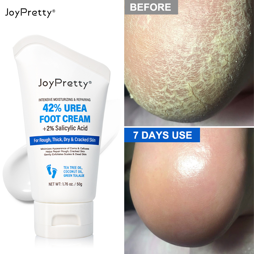 Best of Joypretty Exfoliator Foot Cream Dead Skin Remover Heel Crack Repair Cream Treatment Moisturizing Hand Feet Skin Care Foot Mask Reviews & Tips