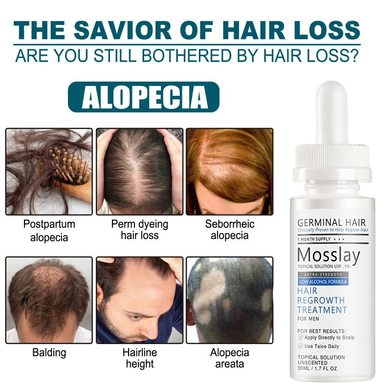 Mosslay Hair Growth Products Essence Oil Hair Care Hair Treatment Hair  Growth Serum Organic Anti Hair Loss Beauty Products - Hair Growth Essential  Oils - AliExpress