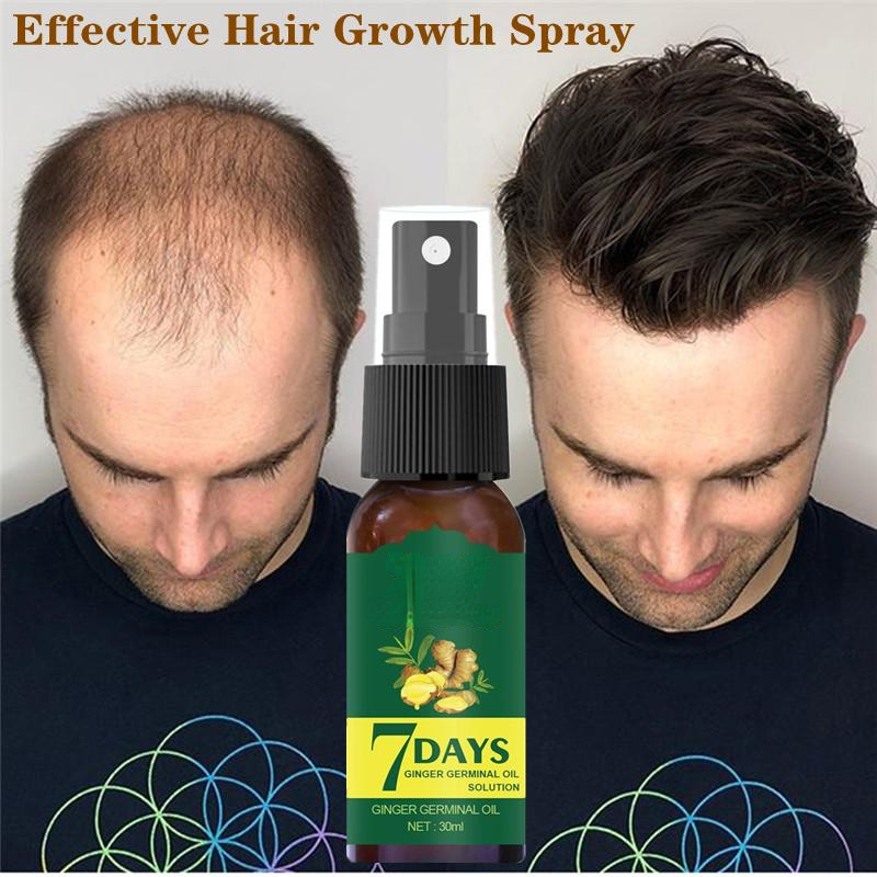 Best of 7 Days Ginger Hair Growth Spray Oil Men Women Fast Promote Hair Grow Thicker Anti Hair Loss Scalp Treatment Nourish Hair Reviews & Tips