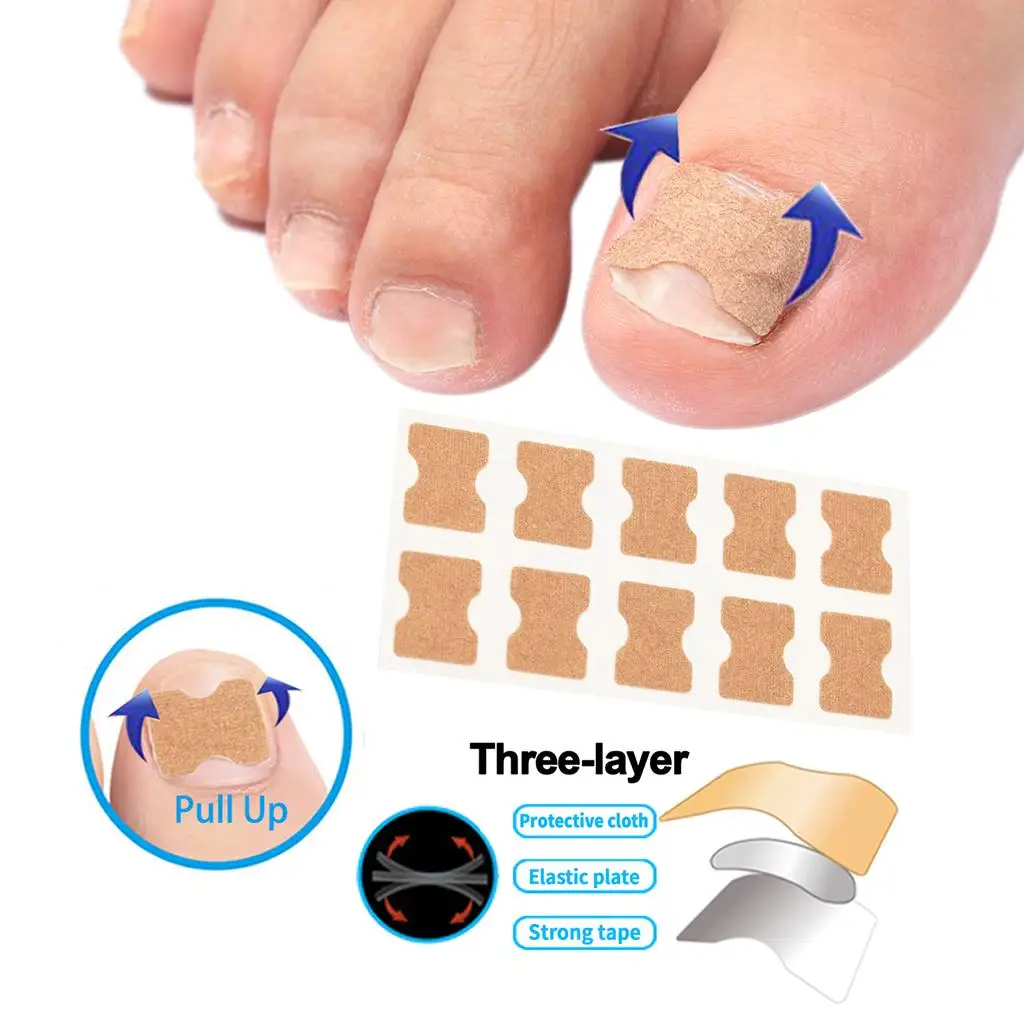 Toe Nail Foot Corrector Stickers Fixer  Correction Tool