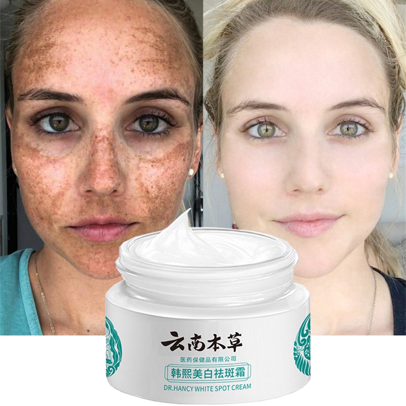 Best of Effective Whitening Freckle Cream Remove Melasma Dark Spots Melanin Reduce Fine Lines Moisturize Brighten Smooth Skin Beauty Reviews & Tips