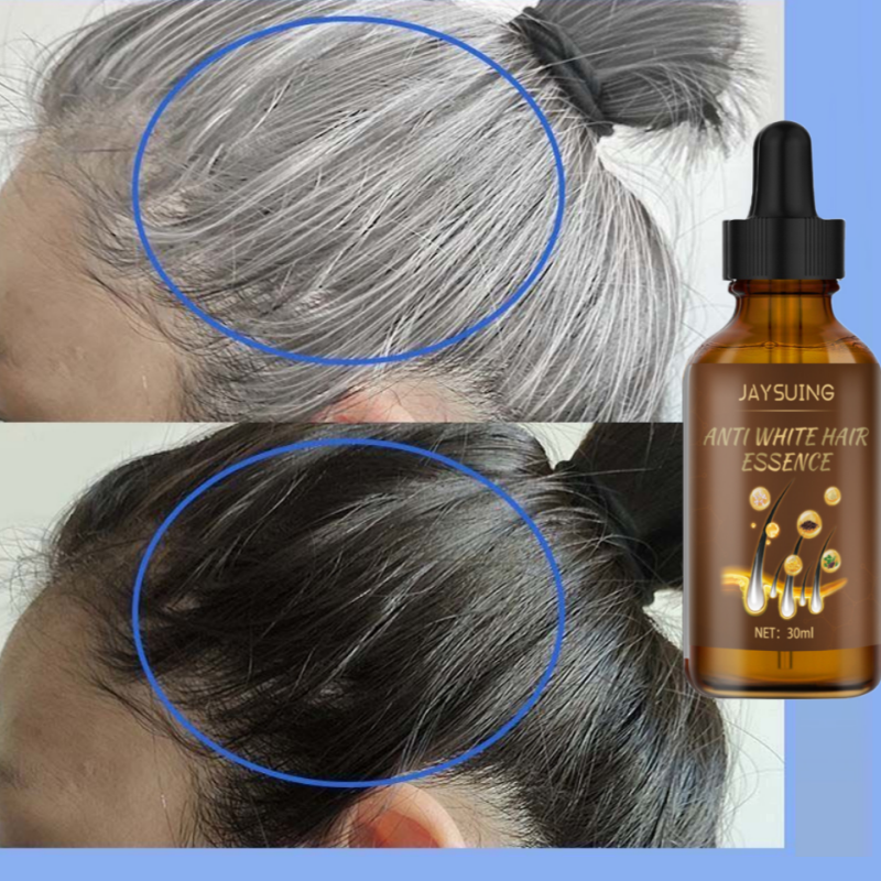 Best of Lasting Anti Gray Hair Treatment Serum White To Black Hair Growth Natural Color Repair Nourish Men Women Anti Hair Loss Products Reviews & Tips