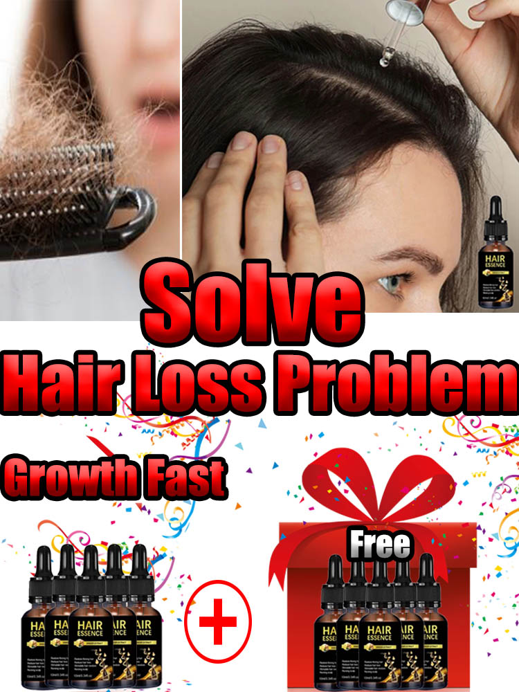 Best of Hair Growth Oil, effective Baldness Repair, Hereditary Hair Loss, Postpartum Hair Loss Reviews & Tips