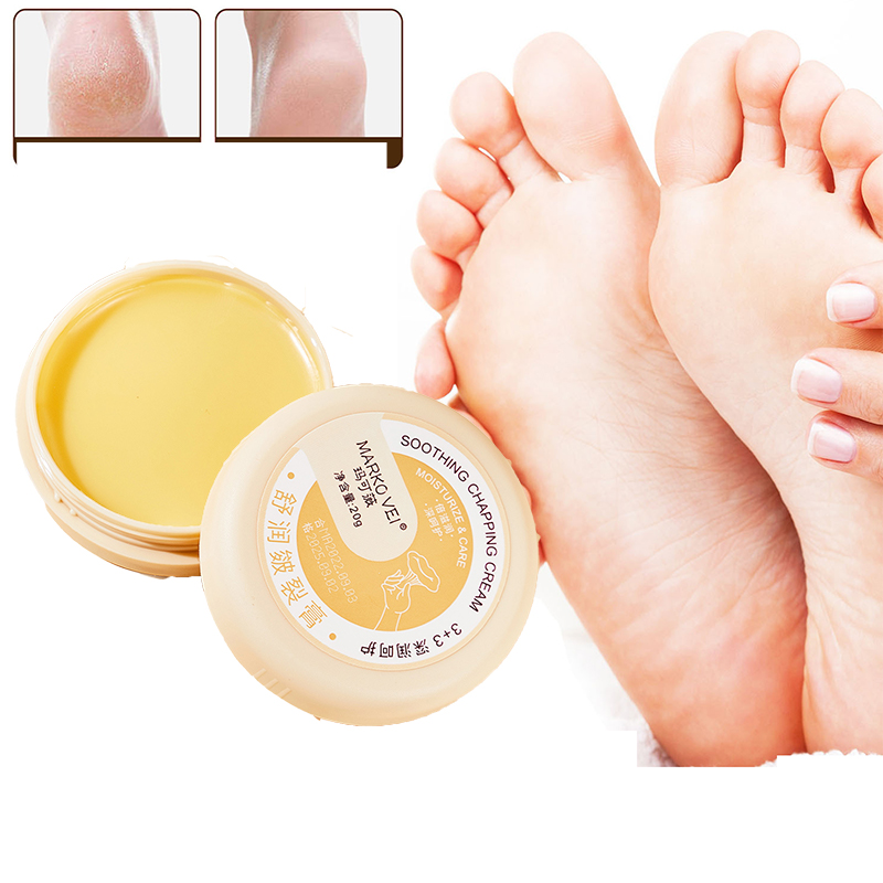 Best of Anti Drying Cracking Foot Cream Heel Cracked Repair Cream Moisturizing Removal Dead Skin Hand Chapping Cream Feet Skin Care 20g Reviews & Tips