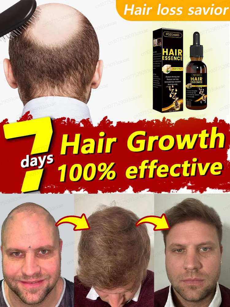 Best of Hair Growth Essence Can Quickly Grow Hair And Effectively Repair Baldness, Alopecia Areata, Hereditary Hair Loss, Postpartum Hai Reviews & Tips