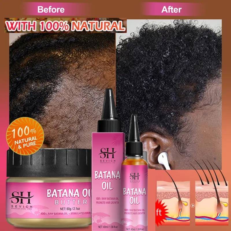 Best of African Batana Oil Fast Hair Growth Set Fast Repair Baldness Hereditary Hair Regrowth Treatment Serum Hair Growth For Men Women Reviews & Tips