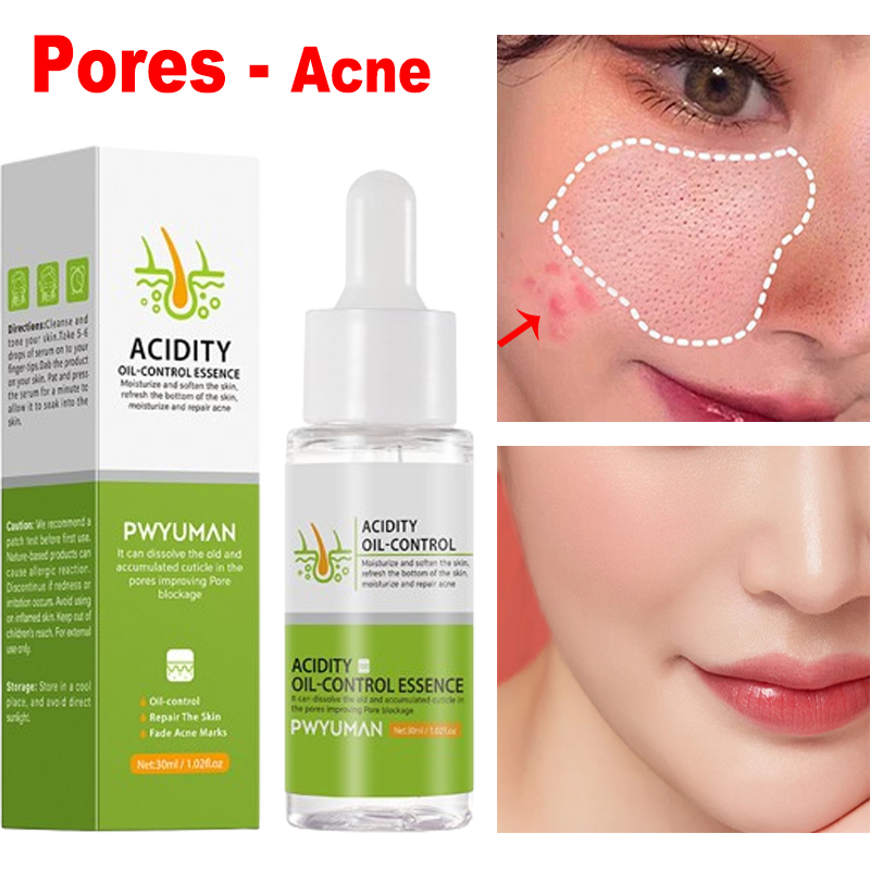 Best of Pore Shrinking Serum Aloe Vera Gel Firming Repair Shrink Pores Sunburn Redness Acne Skin Moisturizing Anti-Wrinkle Korean Care Reviews & Tips