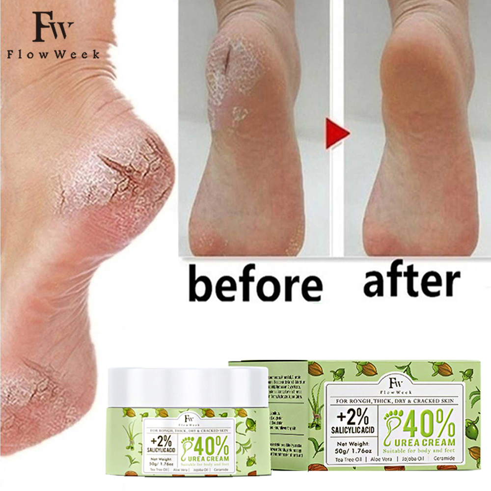 Best of Flow Week Vitamin E Urea Cream Skin Care Cream Urea 40% Foot Cream Callus Remover Foot Moisturizer Corn Callus Dead Skin Remover Reviews & Tips