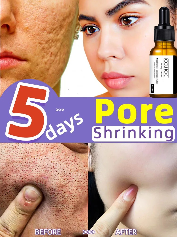 Best of Pore Shrinking Serum Shrink Effective Remover Face Pores Acne Refining Repair Blackhead Treatment Korean Skin Care Products Reviews & Tips