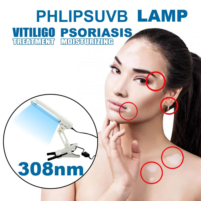 Best of Glenn UVB 308nm Narrow Band UVB Lamps Household UVB Phototherapy For Vitiligo Psoriasis Treatment Reviews & Tips