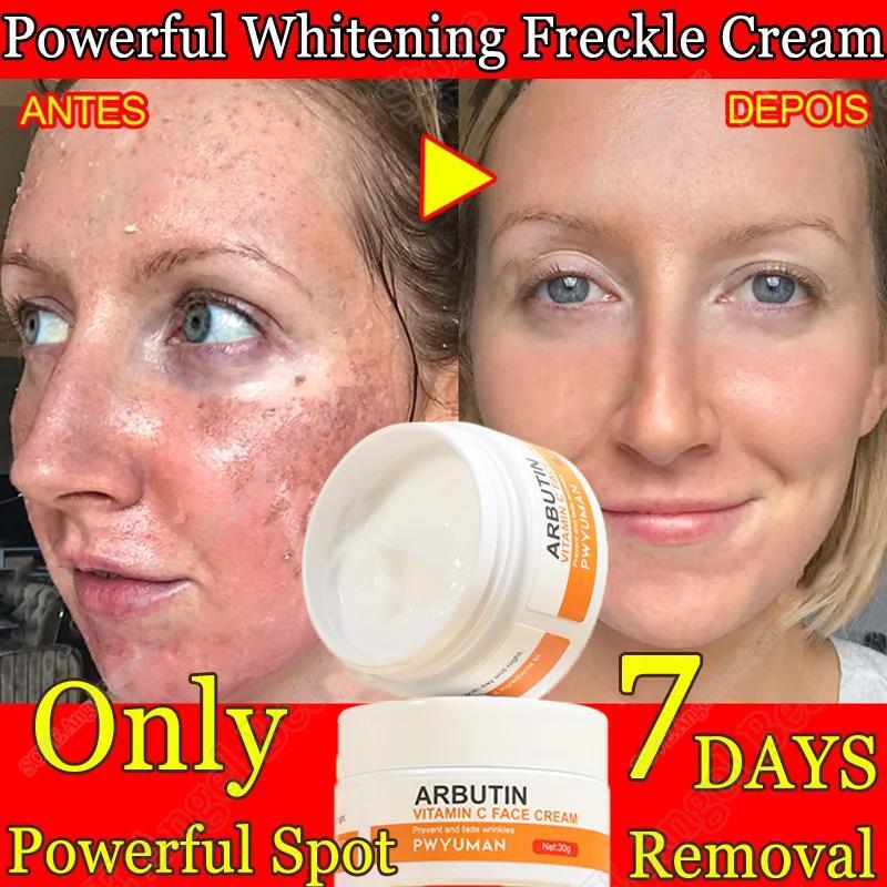 Best of Vitamin C Whitening Face Cream Acne Mark Removal Fade Melasma Dark Spot Acne Spots Anti-Aging Moisturizing Brightening FaceCream Reviews & Tips