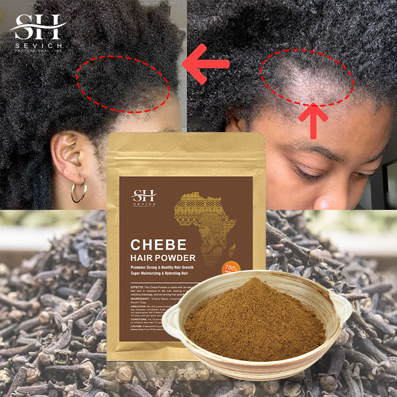 Best of Sevich Hot Sale 100g Chebe Powder From Chad 100% Natural Hair Regrowth 2 Month Super Fast Hair Growth Treatment Get Rid Of Wigs Reviews & Tips