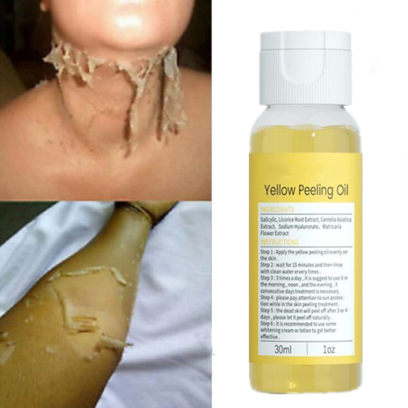 Best of Strong Yellow Peeling Oil Bleaching Dark Skin Retinol With Peptide Spots Blackheads Blemishes Bad Skin Spot Treatment 30ml Reviews & Tips