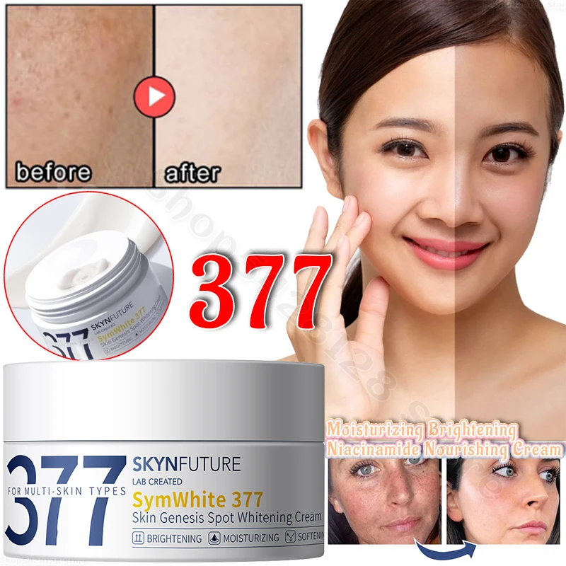 Best of Skynfuture 377 Whitening Cream To Improve Skin Dullness And Brighten Nicotinamide Moisturizing Cream To Lighten Melanin Reviews & Tips