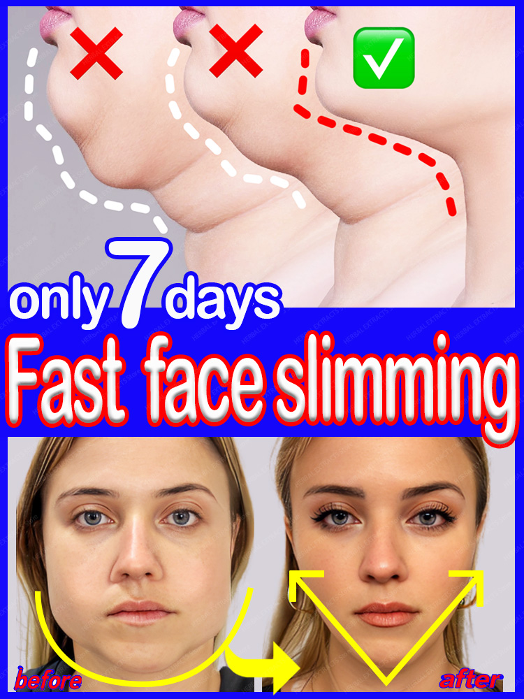 Best of Double Chin V Shape Remove The Face Fat Reviews & Tips