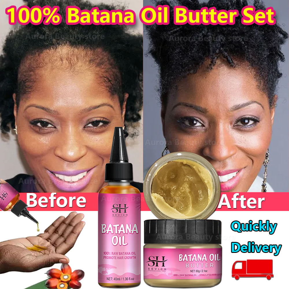 Best of Batana Oil Hair Fast Growth Oils Set African Crazy Traction Alopecia Batana Hair Mask Anti Break Loss Regrowth Treatment Serum Reviews & Tips