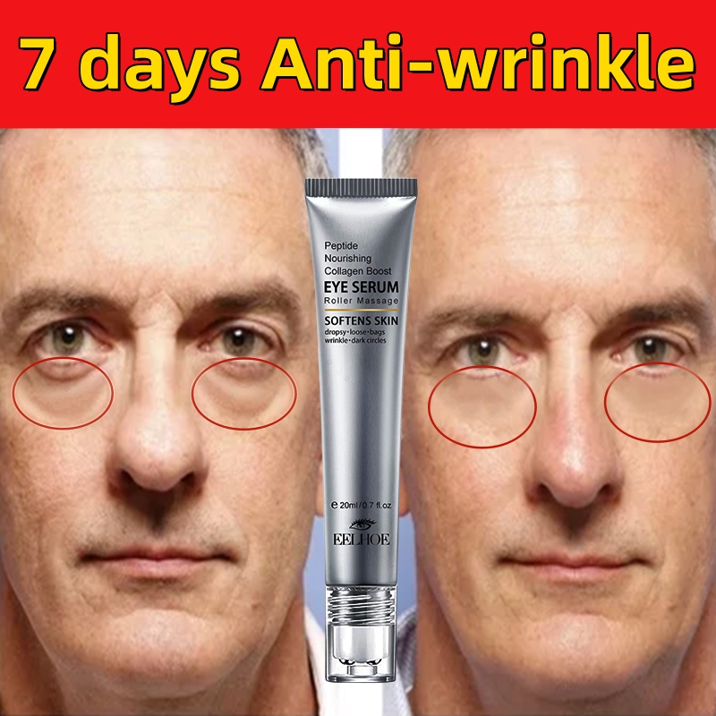 Best of Instant Anti-Wrinkle Eye Cream Removal Dark Circles Bag Puffiness Fade Eye Fine Line Tighten Whitening Roller Massager Skin Care Reviews & Tips