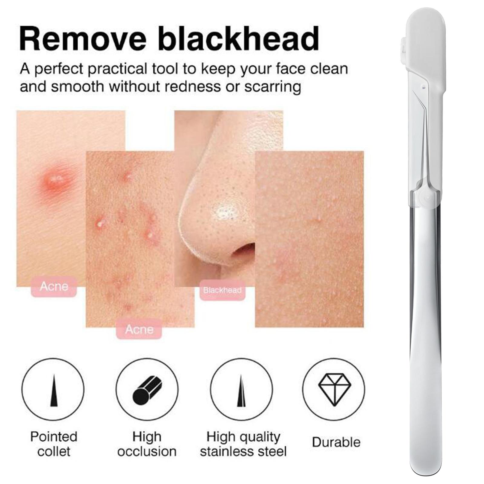 Blackhead Tweezer Remove Blackhead Whitehead Pimple Skin Care Women Blemish Acne Remover Face Beauty Tools Comedone Extractor