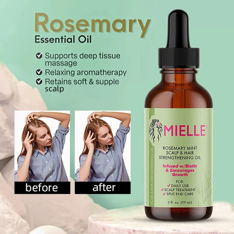 Best of Hair Growth Treatment Oil Fast Hair Growth Products Rosemary Mint Anti Loss Hair Scalp Treatment Serum Beauty Health Mielle Reviews & Tips