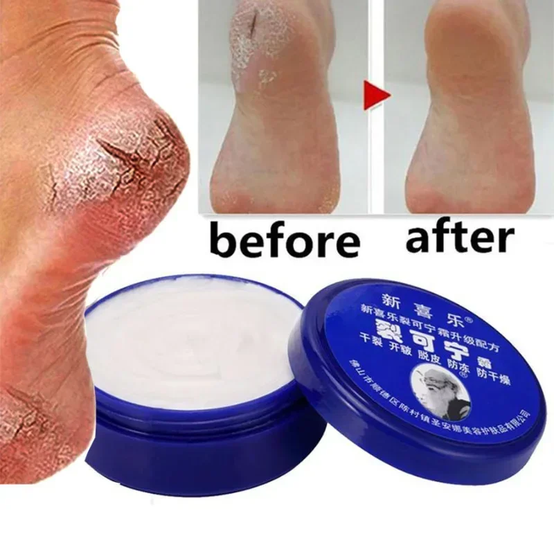 Best of Herbal Anti Crack Foot Cream Oil Anti-Drying Crack Feet Cream Heel Cracked Repair Cream Removal Bad Skin Hand Feet Care Mask Reviews & Tips