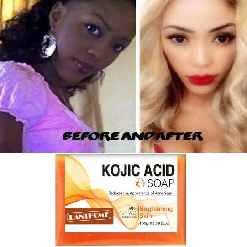 Best of 100g Kojic Acid Soap Original Face Whitening Soap Skin Care Brighten Anti Aging Acne Remove Dark Spot Moisturizing Cleansing Reviews & Tips