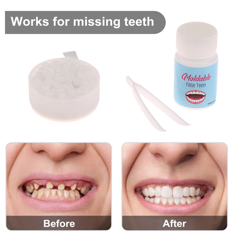 Best of Resin 10g / 15g / 20g Temporary Tooth Repair Kit Teeth And Gaps FalseTeeth Solid Glue Denture Adhesive Teeth Whitening Tooth Beauty Reviews & Tips - Image 3