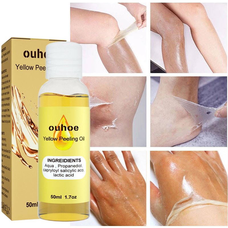 Best of Yellow Peeling Oil Dark Skin Bleaching Serum Remove Arm Knee Legs Melanin Body Brighten Scrub Exfoliating Dead Skin Care Product Reviews & Tips