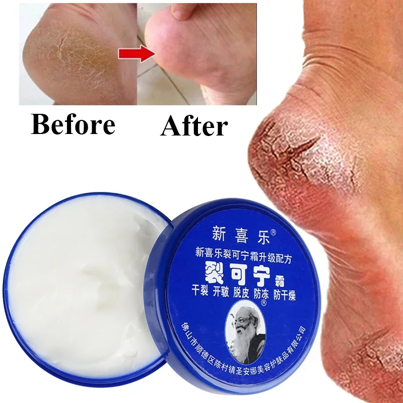 Best of Traditional Chinese 85g Oil Anti-Drying Crack Foot Cream Heel Cracked Repair Cream Removal Dead Skin Hand Feet Care Foot Mask Reviews & Tips