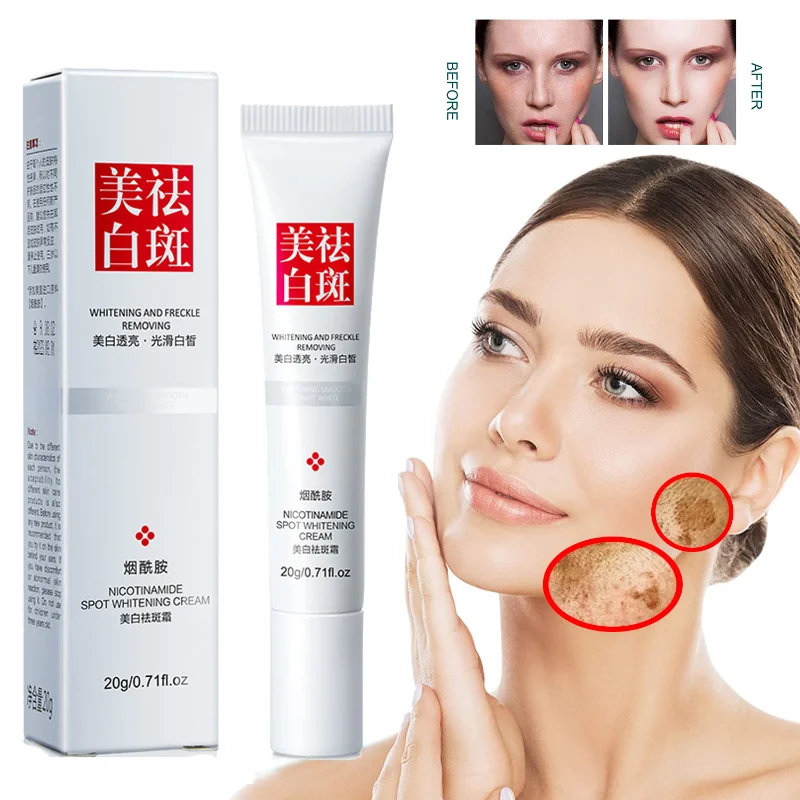 Best of Fades Freckle Dark Spots Face Cream Niacinamide Whitening Cream Vitamin E Improve Dullness Fast Brighten Nourish Skin Care Reviews & Tips