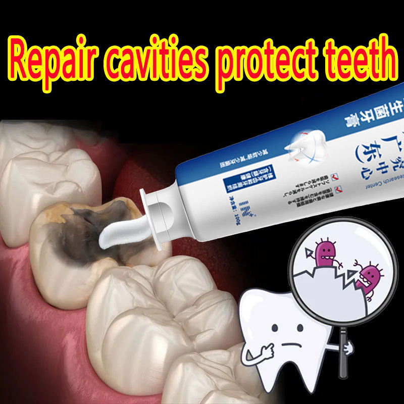 Best of 2023 New Quick Repair Of Cavities Caries Removal Of Plaque Stains Decay Whitening Yellowing Repair Teeth Teeth Whitening Reviews & Tips