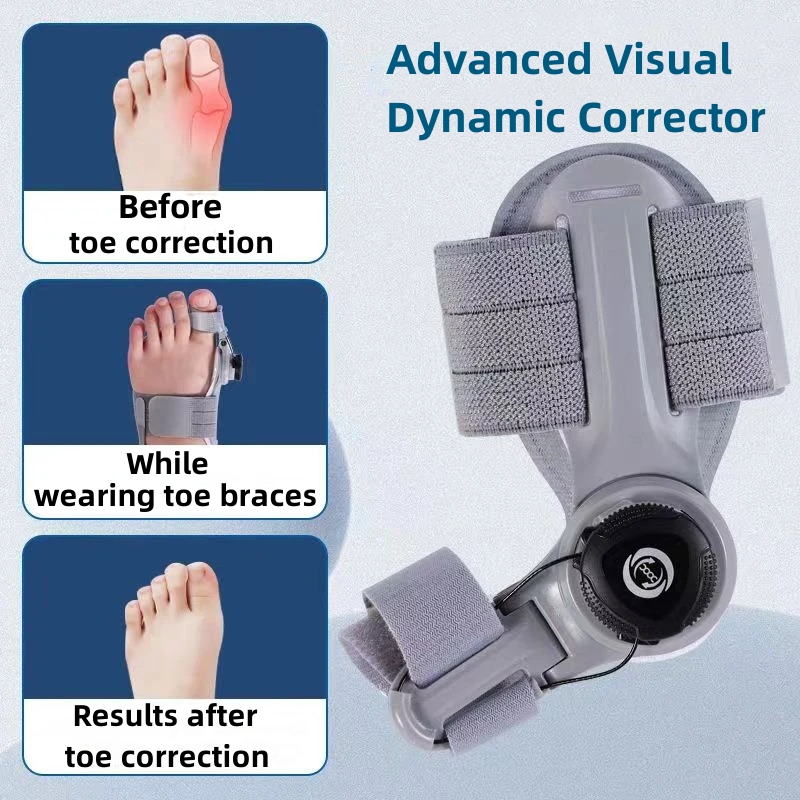 Best of Adjustable Bunion Corrector Big Toe Separator Unisex Hallux Valgus Corrector Foot Orthopedic Tools Bunion Splint Straightener Reviews & Tips