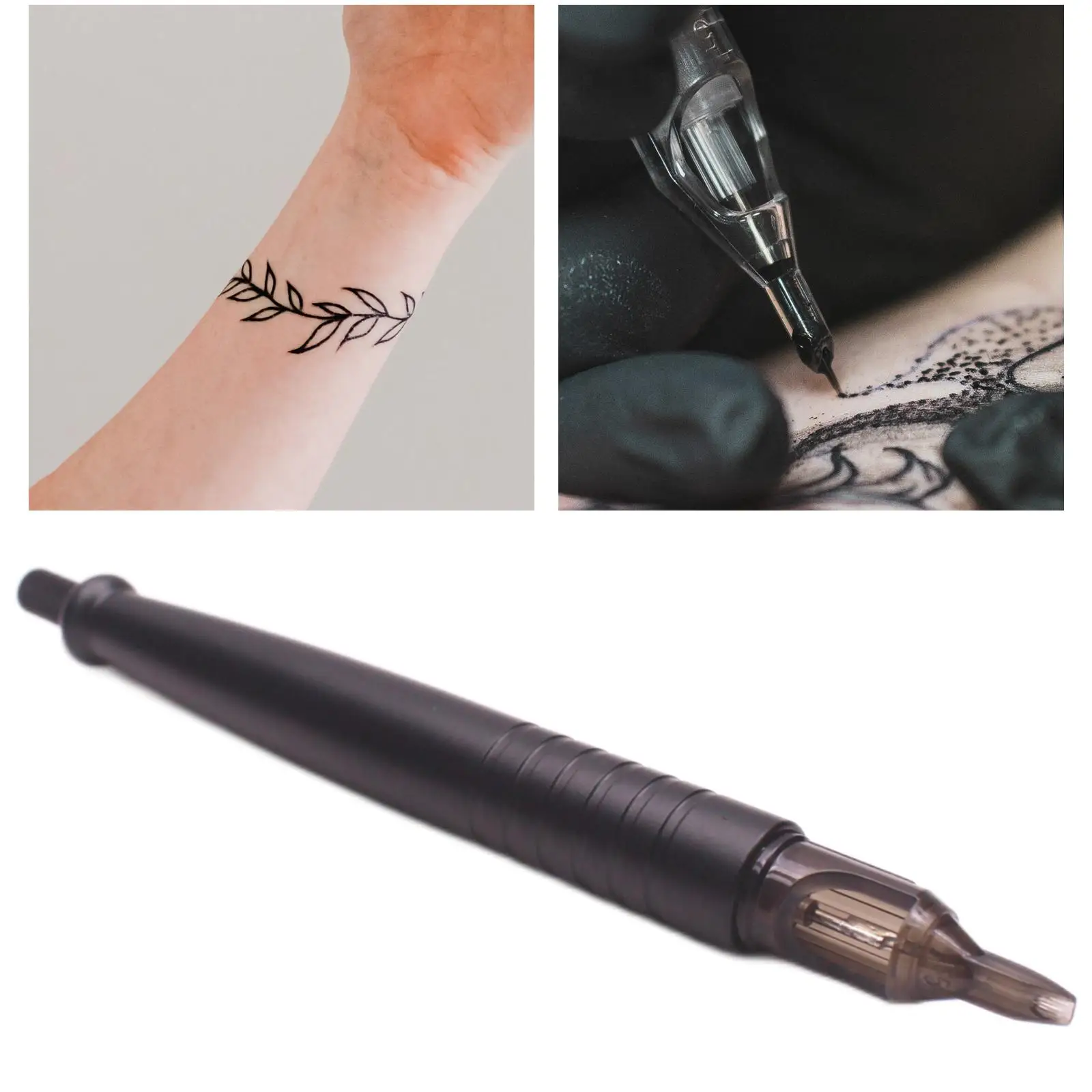 Лазерное удаление татуировки ручкой