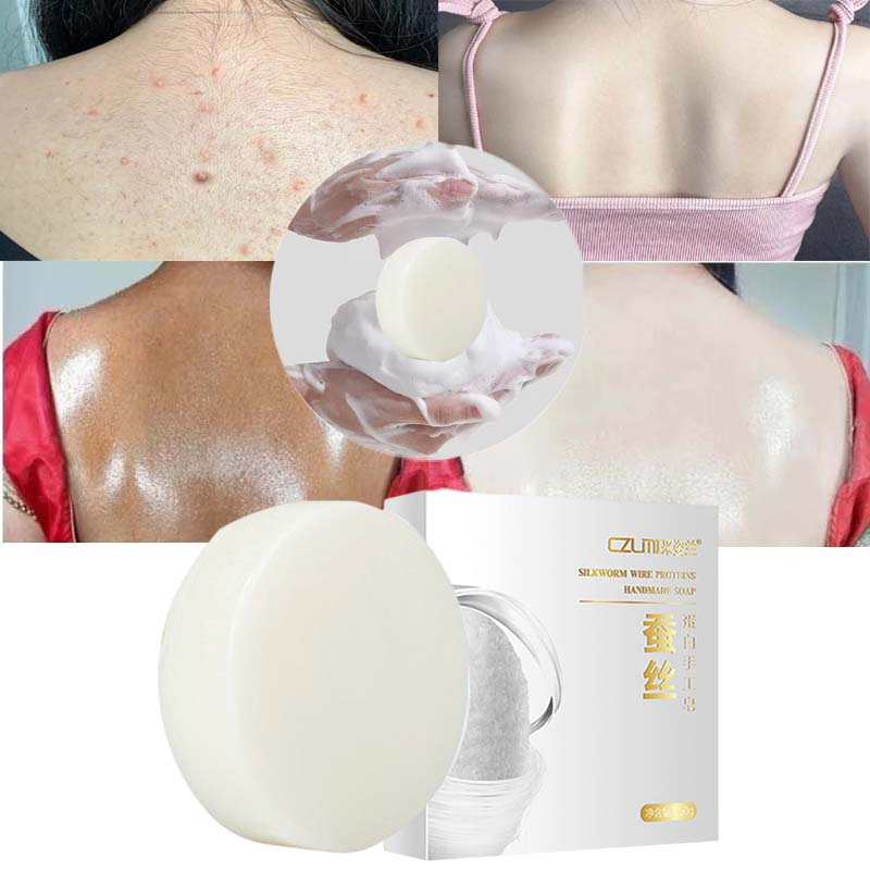 Best of Effective Body Whitening Soap Dark Spot Chicken Dead Skin Removal Bleaching Treatment Underarm Knees Moisturizing Brighten Care Reviews & Tips