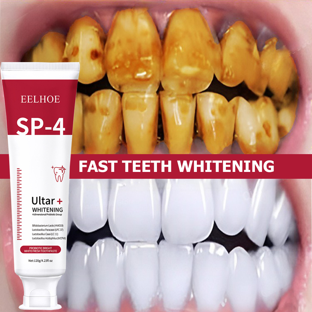 Best of Probiotic Caries Toothpaste SP 4 Whitening Tooth Decay Repair Paste Teeth Cleaner Plaque Remover Fresh Breath Dental Care 120g Reviews & Tips