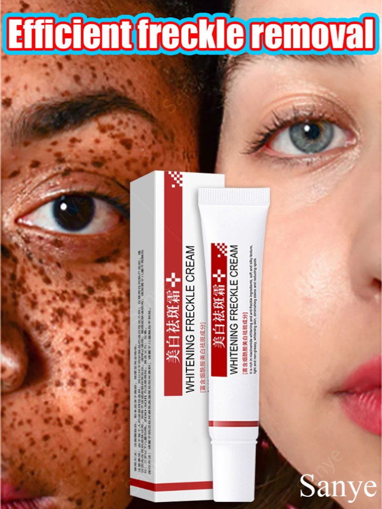 Best of Nicotinamide Whitening Freckles Cream Effective Lightening Dark Spot Remove Cream Face Fade Melasma Korean Brightening Skin Care Reviews & Tips