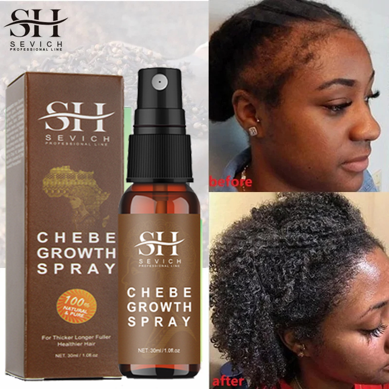 Best of Africa Chebe Anti Hair Loss Products Traction Alopecia Chebe Powder Thickening Oil Anti Break Fast Hair Growth Spray Hair Care Reviews & Tips