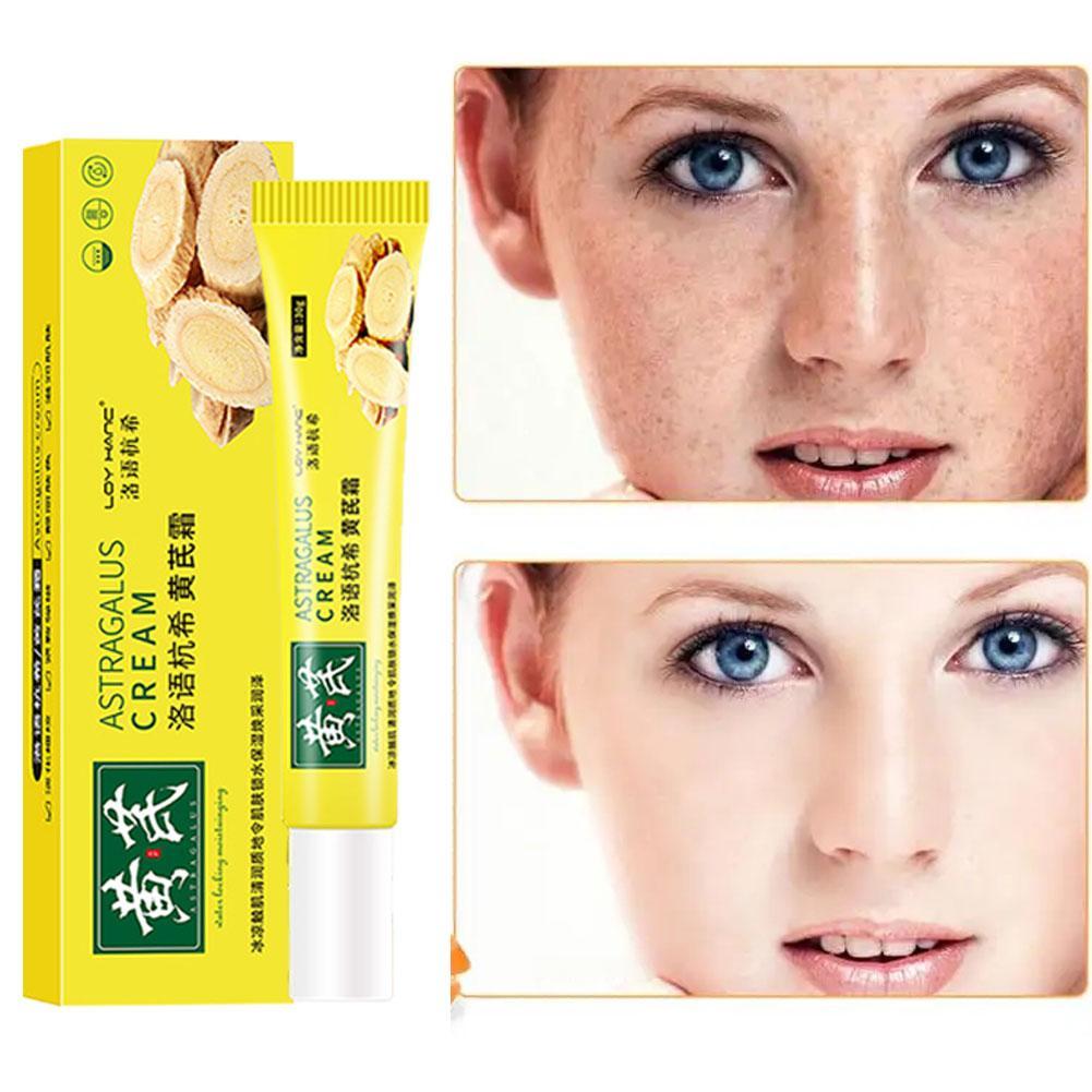 Best of Chinese Astragalus Whitening Freckles Cream Remove Melasma Fade Dark Spots Dark Yellow Skin Brighten Anti-aging Face Skin Care Reviews & Tips