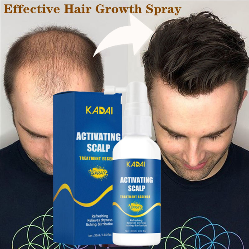 Best of Powerful Hair Growth Serum Spray Anti Hairs Loss Products Treatment Oil Repair Nourish Roots Regrowth Liquid For Men Women 30ml Reviews & Tips