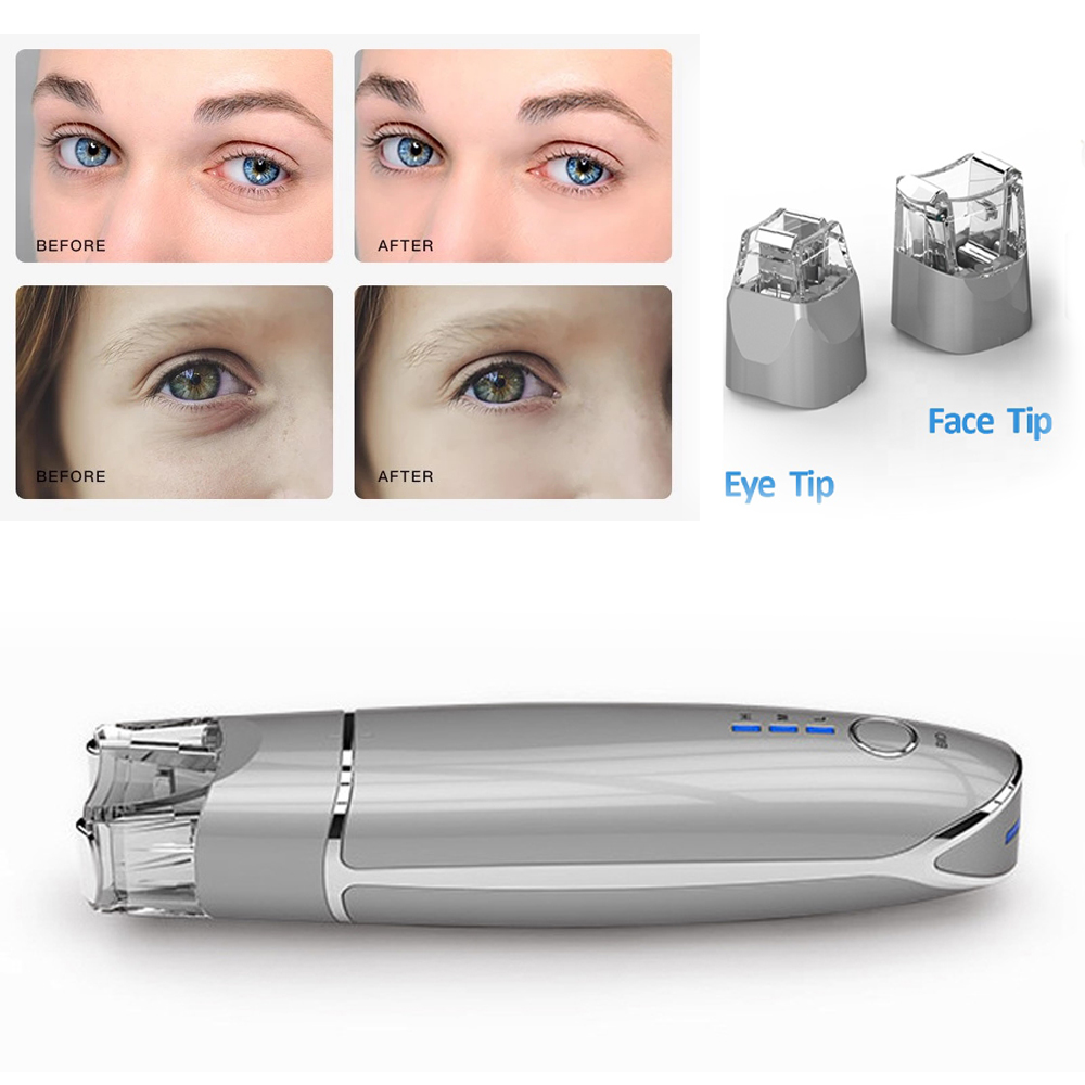 Best of EMS Facial Beauty Instrument Ultrasonic RF Wrinkle Removing Dark Circles Lifting Tightening And Rejuvenating Skin Care Massager Reviews & Tips