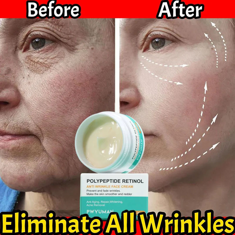 Best of Retinol Wrinkle Removing Face Cream Instant Anti Aging Fade Fine Lines Firming Lifting Moisturizing Brighten Skin Care Cosmetics Reviews & Tips