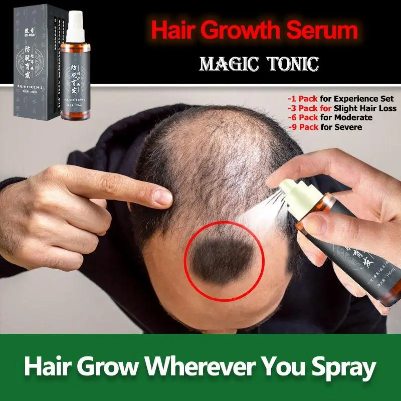 Best of Ginger Hair Growth Spray Anti Hair Loss Essential Oil Products Treatment Hair Thinning Frizzy Fast Growth Serum Men Women Care Reviews & Tips